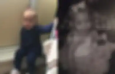 Nyawa Bocah 2 Tahun Ini Tak Selamat Gara-gara Tersedak Camilan, Ingatlah untuk Selalu dan Segera Lakukan Ini Jika Bayi Anda Tersedak