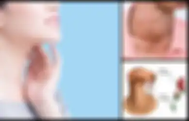 5 Kondisi Kesehatan yang Dapat Dilihat dari Leher, Berbahayakah?