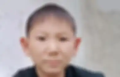 Berusia 34 Tahun Pria Ini Memiliki Wajah Anak-anak Akibat Hal Mengerikan di Masa Kecil, Kini Harus Menderita Karena Penampilannya