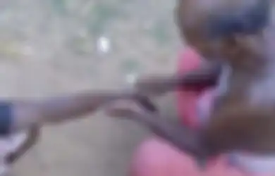 Praktik Miris Seorang Dukun Tradisional, Hanya Gunakan Silet dan Daun Untuk Mengobati Korban Terkena Gigitan Ular