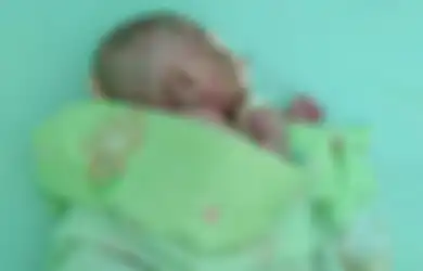 Bayi Ini Tersiksa Karena Kulitnya Keras Seperti Plastik dan Mengelupas hingga Berdarah, Simak Faktor Penyebab Dermatitis Seboroik dan Cara Merawatnya