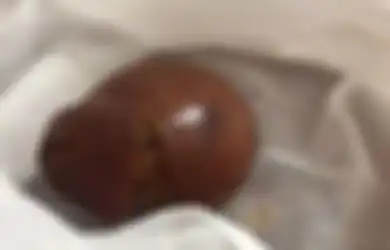 Punya Ayam Tak Kunjung Bertelur?  Cobalah Disembelih, Anda Mungkin Bisa Kaya Raya Jika Temukan Benda Ini