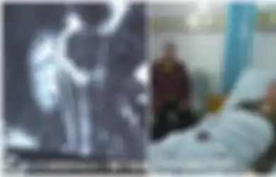 Mengeluh Alami Sakit pada Ginjalnya, Wanita Ini Malah Tertawa dan Menawarkan Ginjalnya Setelah Dokter Memberi Tahunya Hal Ini