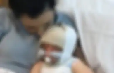 Benar-benar Ceroboh! Wanita Ini Masak Sambil Video Call dengan Ibunya, Akibatnya Anak Balitanya yang Sedang Bermain Terguyur 9 Liter Air Panas Hingga Alami Seperti Ini