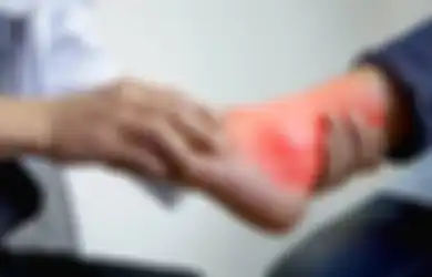 Ternyata Daun Tanaman Jelatang Ini Bisa Untuk Mengatasi Asam Urat