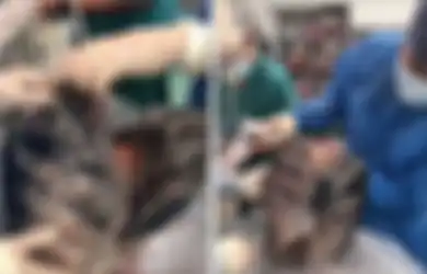 Terima Sumbangan Paru-paru Perokok, Dokter Terheran-heran Melihat Wujudnya Sampai Ogah Menerimanya