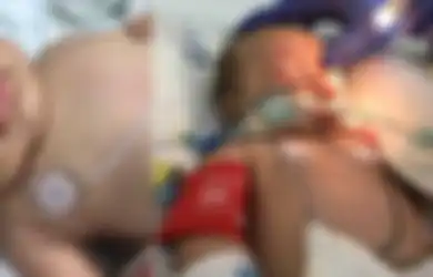 Bayi Ini Koma Setelah Diguncang Terlalu Kencang oleh Ayahnya: Mengenal Sindrom Bayi Terguncang yang Bisa Sebabkan Pendarahan Retina, Koma, Bahkan Kematian