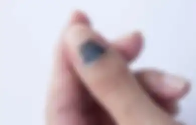 Hati-Hati, Hubungi Dokter Sekarang Juga Jika Lihat Tanda Garis Hitam di Kuku Anda Seperti Ini!