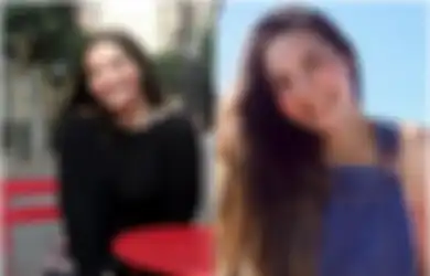 Mahasiswi Cantik Ini Hanya Mandi 2 Kali Sebulan Karena Alergi Air, Keringat atau Air Matanya Sendiri Bisa Memicu Demam dan Ruam