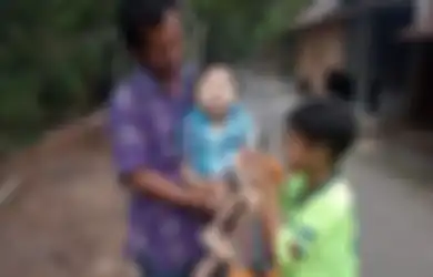 Anak Kecil Yang Lahir Prematur Dari Penderita Kanker Serviks Ini Kondisinya Penuh Belas Kasihan, Seberapa Besar Kemungkinan Kelahiran Prematur Dari Penderita Kanker Serviks?