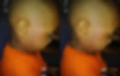 Bayinya Penuh Goresan, Memar, dan Sidik Jari Orang Dewasa, Ibu Ini Marah ke Tempat Penitipan Anak: Ada Seperti Sidik Jari di Kerahnya