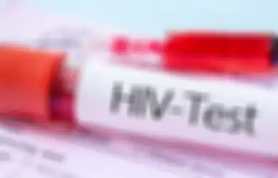 Disebut Penyakit yang Tidak Ada Obatnya, Pasien Ini Jadi Wanita Pertama di Dunia yang Sembuh dari HIV, Tak Disangka Inilah yang Terjadi pada Virusnya