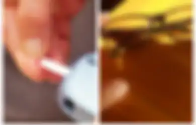 Tidak Hanya Sering Kencing dan Haus, Penglihatan yang Buram Juga Jadi Gejala Awal Diabetes Tipe 2, Kenali Gejala dan Waspadai