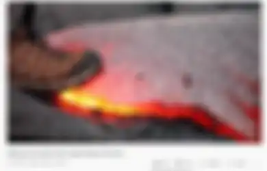 Kawah Gunung Karangetang Terus Keluarkan Lava: Ini yang Terjadi Jika Tubuh Kita Terkena Lava, Kaki Pria Ini Sampai Hancur!