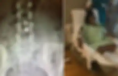 Gunakan KB Spiral, Wanita  Ini Mengalami Nasib Mengenaskan, Indung Telurnya yang Menghitam Diangkat Organ Tubuhnya tak Berfungsi hingga Amputasi