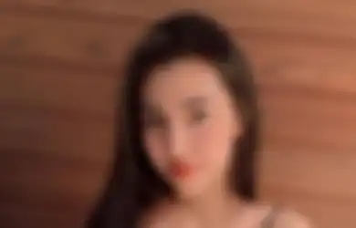 Berubah Terlalu Cantik Akibat Operasi Plastik, Keluarga Wanita Ini Sampai Tidak Bisa Mengenalinya, Rupanya Dulu Seperti Ini Wajahnya
