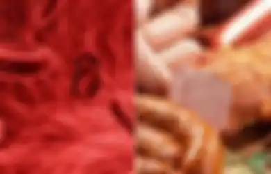 Jadi Penyakit Paling Mengerikan, Makanan Lezat Ini Penyebab Kanker Darah yang Merenggut Banyak Nyawa