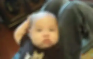 Bayi Itu Terus Menyentuh Kepalanya, Orang Tuanya Mengira Hanya Gatal, Tetapi Karena Terlalu Sering Orang Tuanya Membawanya ke Dokter, Ternyata Situasinya Gawat