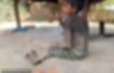 Seperti 'Neraka Kehidupan', Tubuh Gadis 7 Tahun Ini Berubah Jadi 'Batu', Duduk Saja Kesakitan Apalagi untuk Jalan