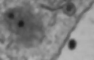 Kepanikan Virus Corona Belum Mereda, Ilmuwan Geger Karena Temukan Virus Misterius Baru: Gennya Sama Sekali Tidak Dikenal Oleh Ilmuwan