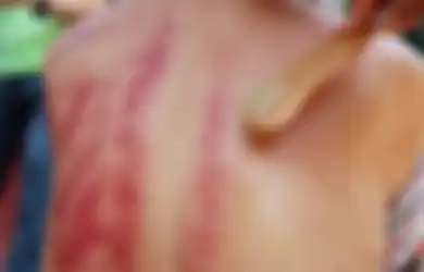 Bisa dengan Tanduk Kerbau atau Sendok Sup, Ternyata China Juga Punya Kebiasaan 'Kerokan' Sendiri, Berikut Manfaat Gua Sha yang Mampu Mengatasi berbagai Penyakit