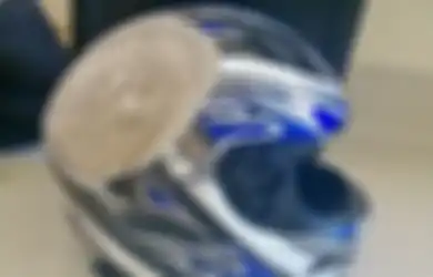 Ketika Hidup dan Mati Hanya 'Dipisahkan' oleh Helm, Foto-foto Ini Tunjukkan Bagaimana Helm Berhasil Menyelematkan Penggunanya dalam Kecelakaan, Nyaris!