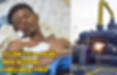Lagi-lagi China Disebut Biang Keladinya, Muncul Penyakit Misterius di Afrika, Pasien Alami Telapak Tangan dan Mata Menguning, Pendarahan Lalu Mati, Sudah Ada 2.000 Orang Mati