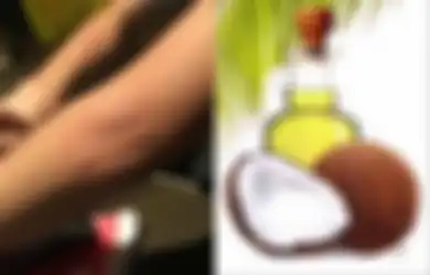 Bila Dirasa Biduran Tak Kunjung Sembuh, Ini Obat Biduran Herbal yang Bisa Dicoba di Rumah, Salah Satunya Minyak Kelapa
