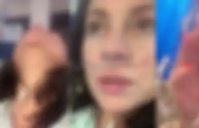 Awalnya Sepelekan Virus Corona dan Menganggapnya Omong Kosong, Wanita Ini Justru Terinfeksi dan Bagikan Video Mengerikan: 'Lihat Saja Saya, Ini Sangat Buruk'