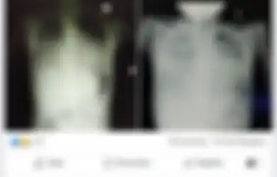 Meski Anda Sudah Terjangkit Corona dan Kemudian Sembuh, WHO Sebut Belum Ada Bukti Anda Bisa Kebal dari Covid-19