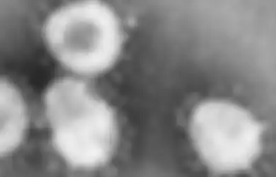Disebutkan Bisa Berubah dengan Satu Mutasi Per Bulan, Nyatanya Sudah ada Laporan Lebih dari 4300 Mutasi dari Virus Corona Sars-CoV-2, Paling Ringan Justru yang di Amerika!