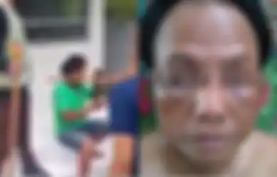 VIRAL! Dituding Sebagai Maling Tanpa Bukti, Tukang Becak di Solo Ini Babak Belur Dipukuli Segerombolan Satpam, Terungkap Kronologi Kejadiannya yang Bikin Hati Miris