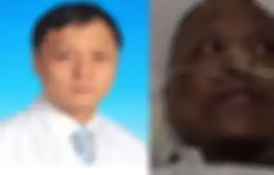Aneh, Kulit Dua Dokter di China Berubah Jadi Hitam Setelah Jalani Perawatan Virus Corona, Diduga Inilah Penyebabnya