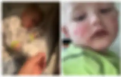 Tunjukkan Gejala Covid-19, Anak Laki-laki 3 Tahun Ini Seolah Tak Bernyawa Seperti Zombie, Dokter Justru Mendiagnosisnya dengan Penyakit Langka Ini