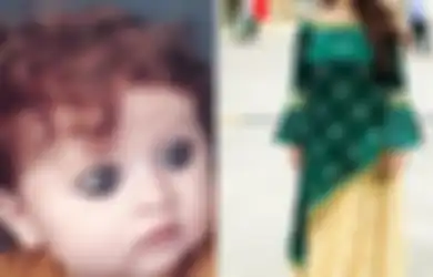 Dijuluki 'Monster' Saat Kecil Gara-gara Warna Kulit dan Matanya, Justru Setelah Dewasa Wanita Ini Jadi Primadona Kaum Lelaki