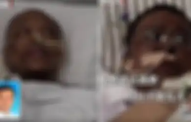 Sempat Viral Seorang Dokter yang Kulitnya Menghitam Gara-gara Terinfeksi Covid-19 Meninggal, Rakyat China Mendadak Marah atas Kematiannya, Ada Apa?