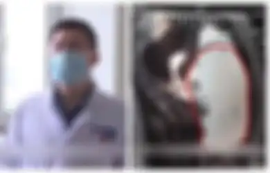 Orang Tua Panik Mengetahui Anak Gadisnya yang Baru Berusia 15 Tahun Hamil Perutnya Terus Membesar, Setelah Periksa ke Dokter, Orang Tua Makin Syok