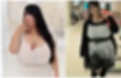 Punya Payudara Terlalu Besar Hingga 120 Cm, Wanita Jepang Ini Justru Merasa Tersiksa Kerap Rasakan Sakit Pada Bagian Ini 