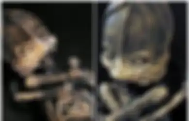 Makhluk Aneh Dipercaya Alien, Tak Disangka Ini Adalah Bayi Manusia, 23 Tahun Terungkap Penyebab Mengapa Wujudnya Sangat Mengerikan