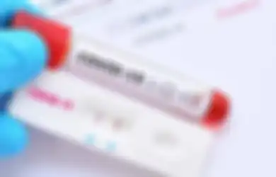Ada 3 Jenis Test Covid-19, Rapid Test, Swab Test dan TCM, Apa Perbedaannya dan Mana yang Lebih Akurat?