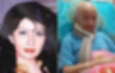 Belajar dari Artis Yana Zein, Pengaruh Kosmetik Bisa Tingkatkan Risiko Kanker Payudara