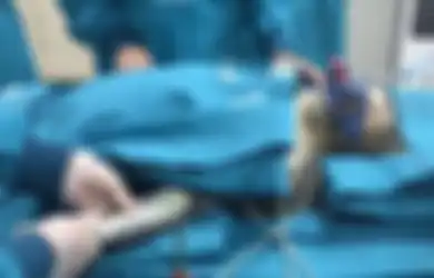 Lagi-lagi China Terungkap Bikin Ekperimen Gila, Monyet Hatinya Dicangkok dengan Hati Babi, Hasilnya Mengejutkan Inilah yang Terjadi pada Si Monyet
