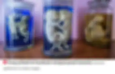 Ada Janin Bayi, Potongan Organ Hingga Mayat Manusia, Inilah Barang-barang Mengerikan yang Dijual di Pasar Gelap Harganya Ada yang  Mencapai Rp1,7 Miliar