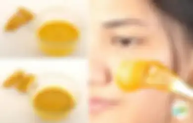 Buat Campuran Kunyit dan Madu untuk Atasi Jerawat Sampai Kumis Tipis pada Wanita, Ini Caranya