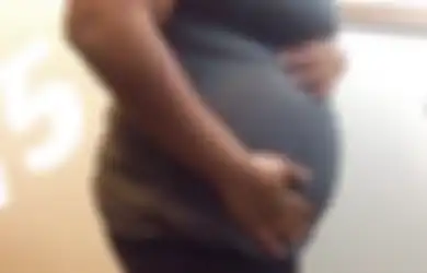 Obat Biduran untuk Ibu Hamil, Hanya Digunakan Jika Kondisi Tidak Baik