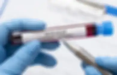 Penting Diketahui, Inilah Perbedan Rapid Test Antigen yang Kini Dijadikan Syarat Perjalanan dengan Rapid Test Antibodi dan PCR