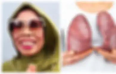 Meninggal Dunia, Komedian Omas Punya Riwayat Penyakit Komplikasi, 6 Cara Ini Dapat Menjaga Paru-paru Anda Tetap Sehat