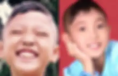  Dulu Rela Gunduli Rambut Demi Jadi Gadis Plontos, Penampilan Pemeran Ronaldowati Kini Bikin Pangling, Begini Tampilannya yang Sangat Berbeda!