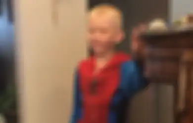 Lindungi Adiknya dari Serangan Anjing, Bocah Pemberani Ini Tarik Perhatian Robert Downey Jr. dan Tom Holland