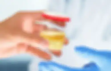 Jangan Dianggap Remeh!Segera Periksakan Saat Kamu Mendapati Urine Berbusa, Pertanda Adanya 4 Penyakit Ini